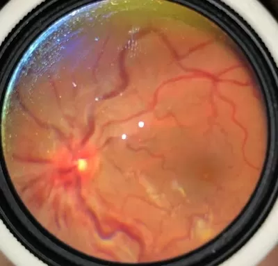 Dr. K.P’s Eye Care and Laser Centre