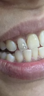 Shukra Dental Centre Mint