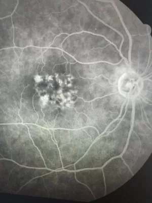 Sudhalkar Eye Hospital and Retina Centre